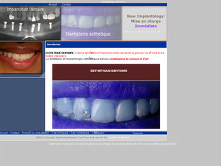 Aperçu visuel du site http://www.implantdentairetunisie.com/