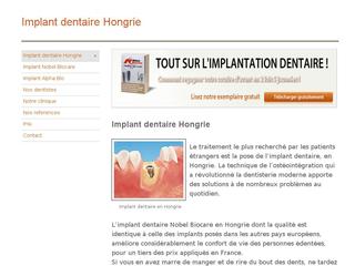 Aperçu visuel du site http://www.implant-dentaire-hongrie.com